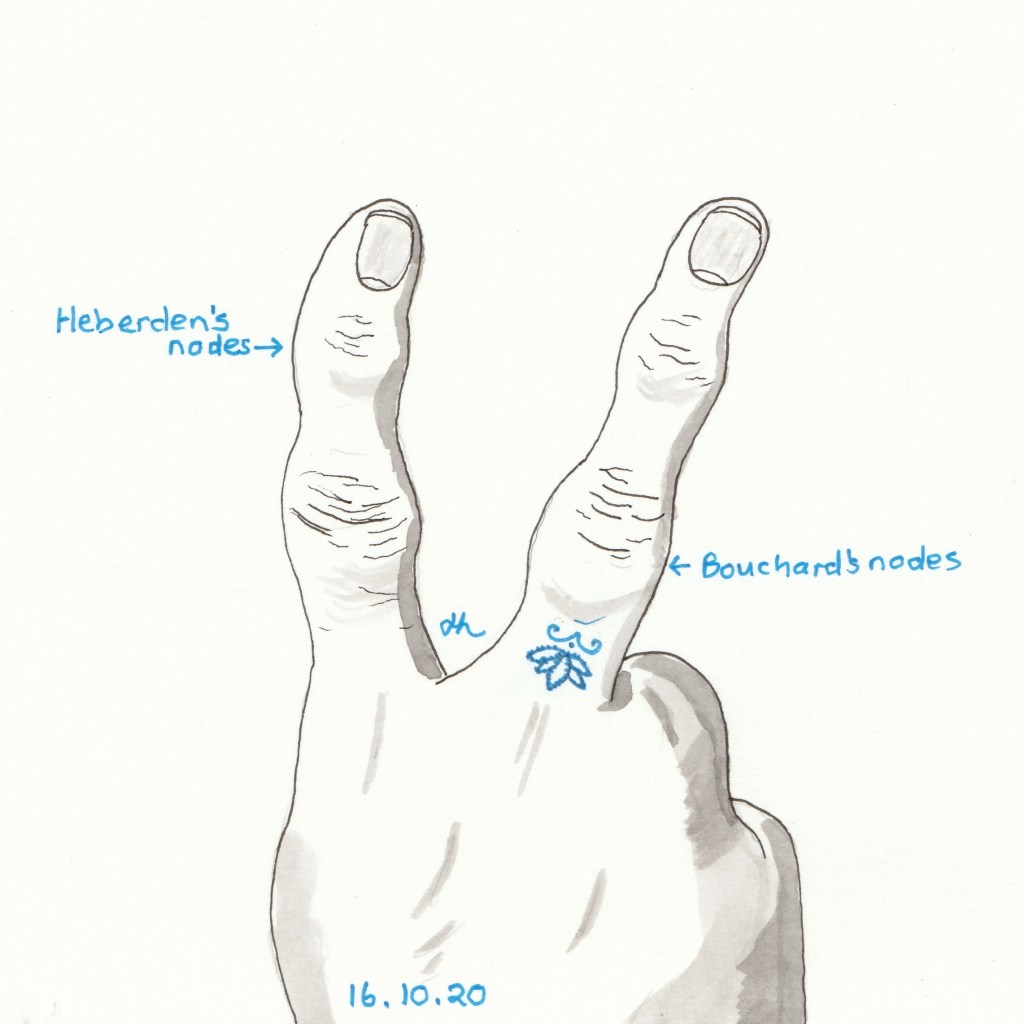 Osteoarthritis - #Inktober2020 Day 16 - Helen Lock - One Day At A Time 